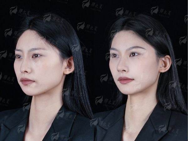 <strong>三、<strong>深圳艺星医疗美容医院的隆胸技术有什么优势？</strong></strong>
