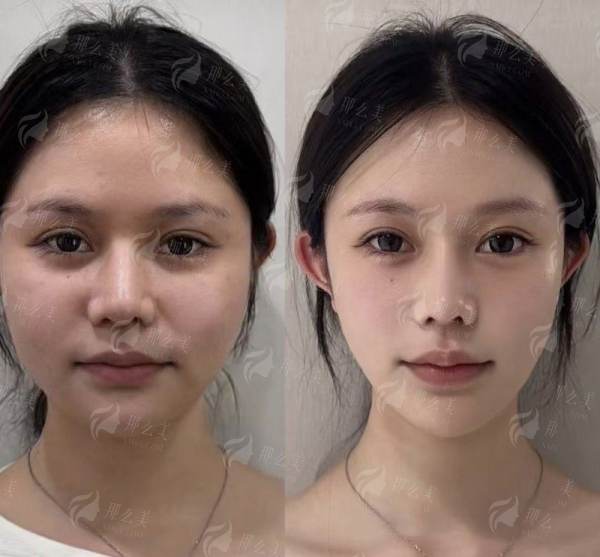 <strong>疑难性皮肤问题治疗的特色方式与“武器库”</strong>