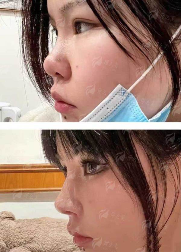 <strong>从服务到口碑:全方面保护修复体验</strong>