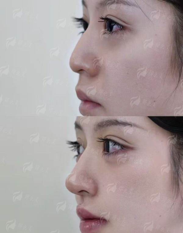<strong>二、上海东方丽人医疗美容的耳畸形矫正骨干医生团队好吗?</strong>