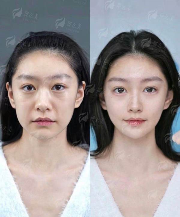 <strong style="color: rgb(255, 0, 0);">特色项目：苏虹医生的微创注射美容如何“量体裁衣”？</strong>