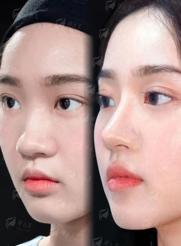 <strong>患者真实口碑：成效是更好的代言</strong>