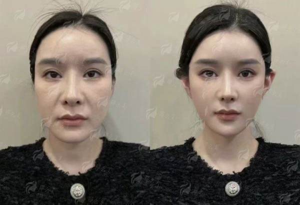 <strong>四、<strong>如何预约北京米扬丽格的鼻修复面诊？</strong></strong>
