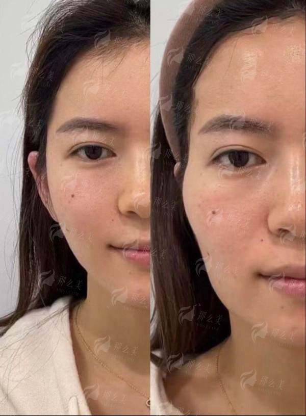 杨召辉医生12年经验专注眼部，平顶山星美双眼皮口碑之选，新颜智尚小程序预约