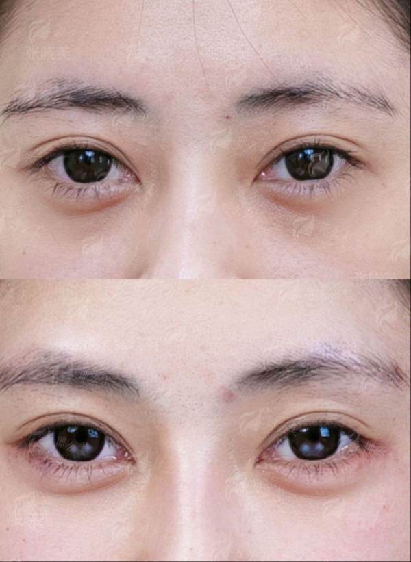 在包头做植发，吴姝华美怎么样？新颜智尚小程序一键预约，查看真实用户反馈