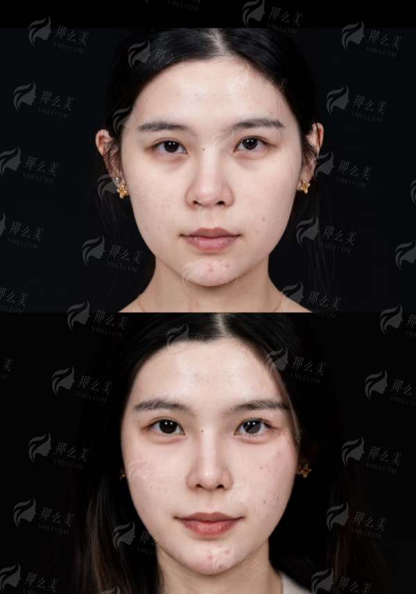 <strong>二、平顶山星美杨召辉医生的双眼皮,有哪些特色和优势?</strong>
