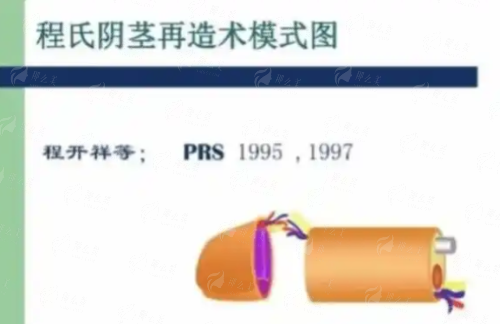 <strong>四、<strong>如何选择与预约湖北武汉真爱私密的阴唇整形?</strong></strong>