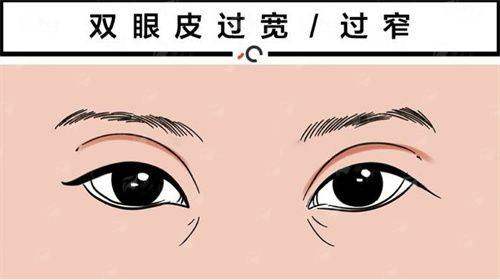 <strong>三、在上海韩卓做双眼皮,价格与流程是怎样的?</strong>