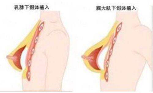 <strong>四、选择遵义韩美美容医院杨艳艳医生,如何开启你的抗衰之旅?</strong>