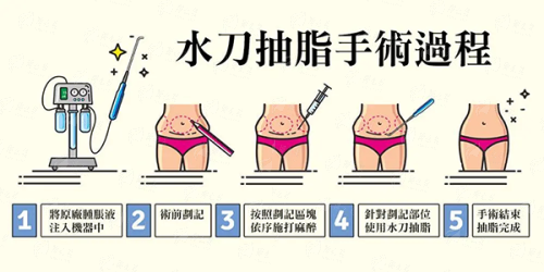 <strong>四、<strong>江苏苏州铂蔓医疗美容的富贵包整形该如何选择与总结？</strong></strong>