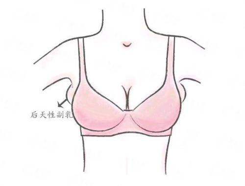 <strong>二、合肥普瑞眼科医院的飞秒激光手术技术好吗?</strong>