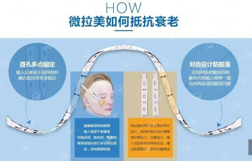 <strong>三、<strong>在江西抚州佰诺口腔做隐形矫正需要注意什么？</strong></strong>