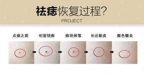 <strong>三、深圳鹏程整形医院刘冰医生假体丰胸的价格与方案如何？</strong>