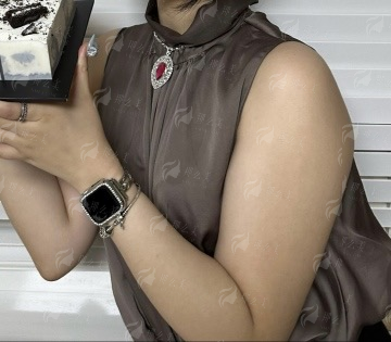 <strong>二、江苏苏州问兰医疗美容贾飞医生双眼皮整形,如何实现创伤小与修复快?</strong>