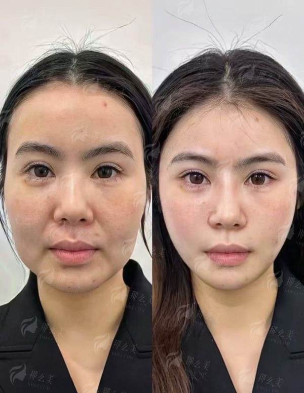 <strong>四、<strong>广西北海华美如何选择与预约?</strong></strong>