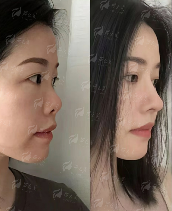 <strong>二、遵义韩美美容医院的杨艳艳医生,皮肤抗衰有哪些特色与仪器?</strong>