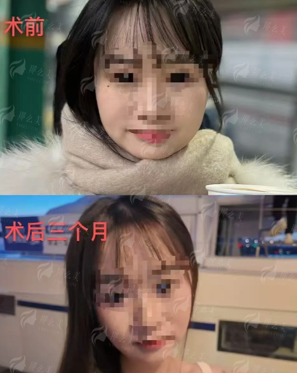 泰州星尚医疗美容精灵耳特色技术，新颜智尚小程序预约，附案例推荐