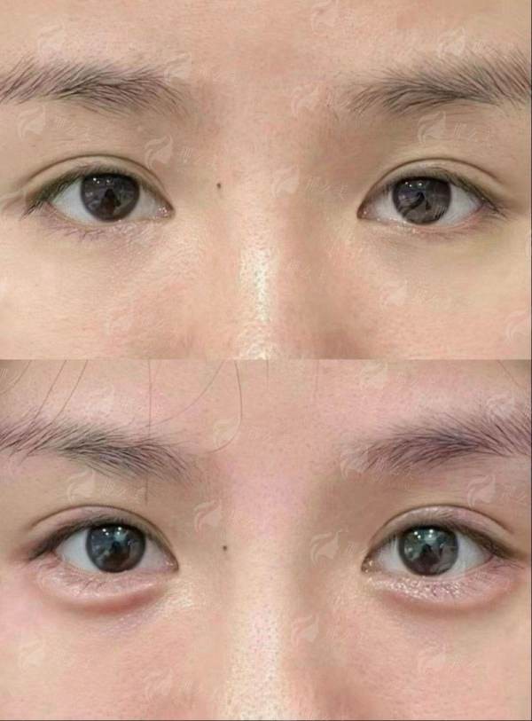<strong>四、<strong>无锡梵伊嘉医疗美容如何选择与预约?</strong></strong>