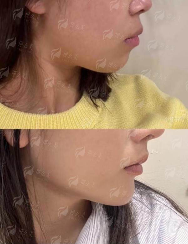 <strong>二、<strong>湖北武汉真爱私密的阴唇整形技术怎么样?</strong></strong>
