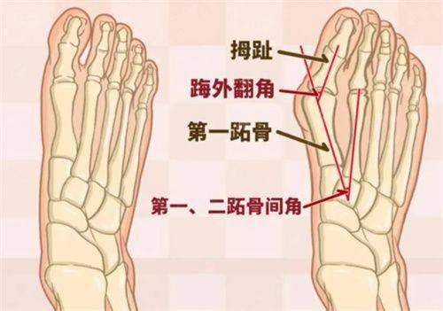 想约南宁华美章建林医生磨骨？新颜智尚小程序预约面诊，附价格优惠攻略