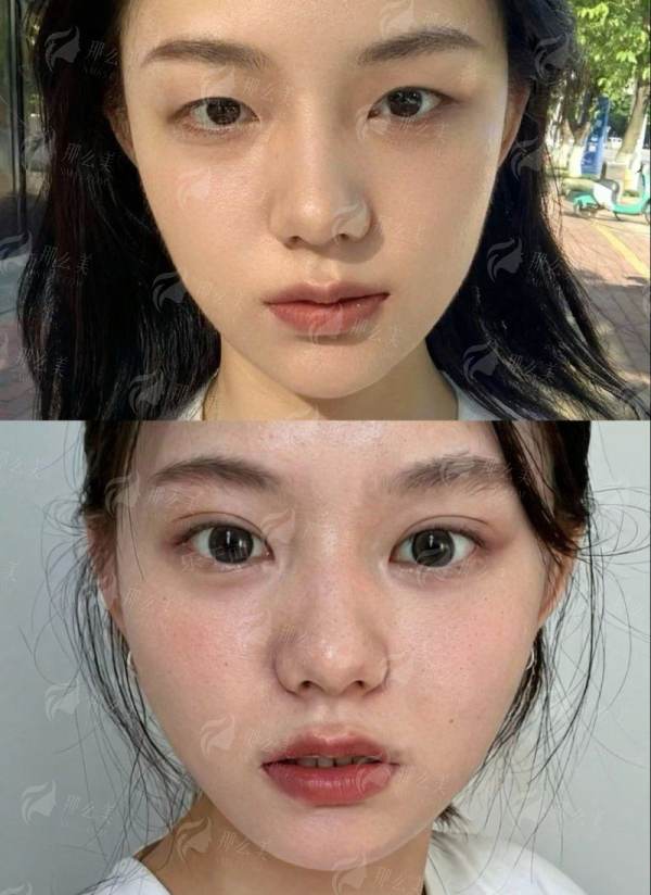 <strong>四、如何选择与预约桐乡星博士医疗美容医院的筋膜支架提升？</strong>