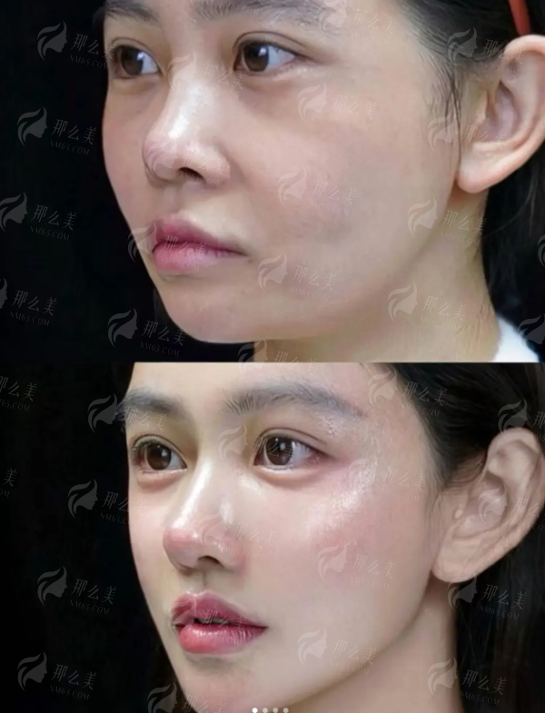<strong>三、选择上海伯思立王艳医生,价格与预约流程是怎样的?</strong>