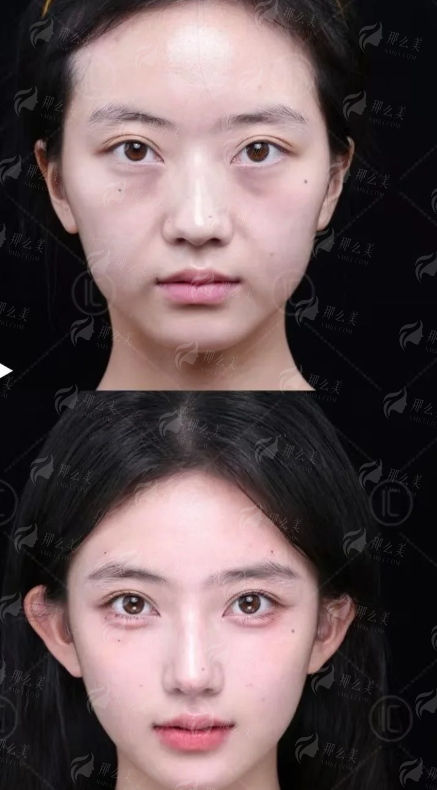 <strong>二、在襄阳新艾伊尔医疗美容找李军平院长做手术，体验和流程是怎样的？</strong>