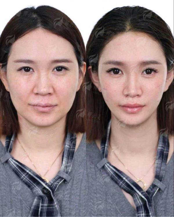 青岛诺德医学美容医院介绍：马昕医生眼修复项目深度剖析，新颜智尚小程序可面诊