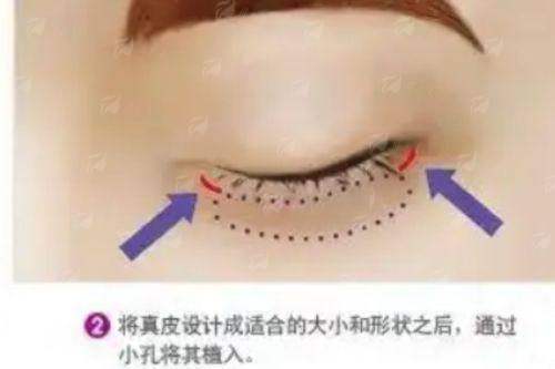 成都晨曦医疗美容医院介绍，林靖眼修复预约火爆，新颜智尚小程序一键约