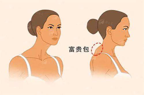 <strong>二、广州广大医院的医生团队如何驾驭PEEK 3D打印？</strong>