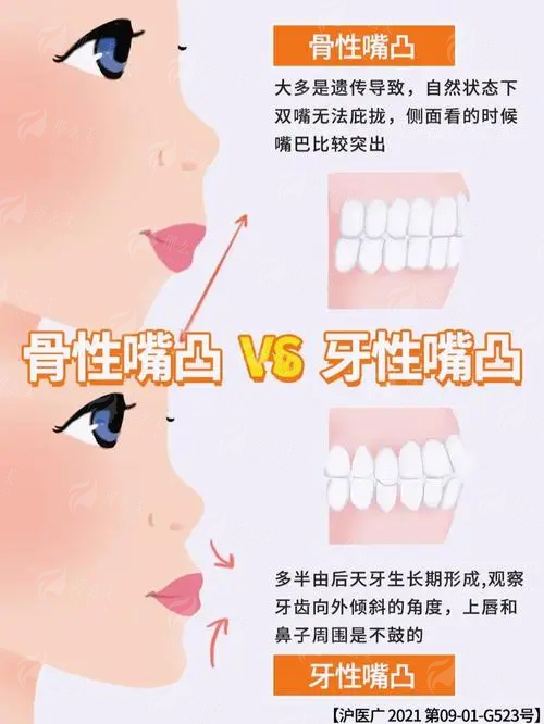 <strong>四、在北京做眼修复,丰联丽格与其他医院如何选?</strong>