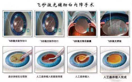 <strong>四、如何在上海爱尚丽格医疗美容做好双眼皮术前准备与术后护理？</strong>