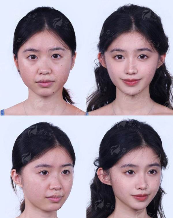 <strong>二、<strong>东莞缔美整形的祛眼袋医生团队实力如何？</strong></strong>