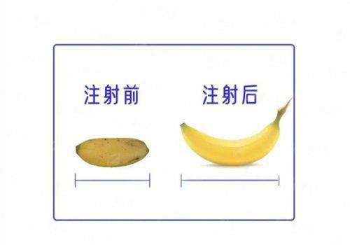 <strong>四、如何理性看待并选择<strong>富贵包</strong>的改善路径？</strong>