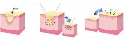 <strong>三、在北京惠合嘉美找齐敏医生做拉皮，服务和口碑怎么样？</strong>