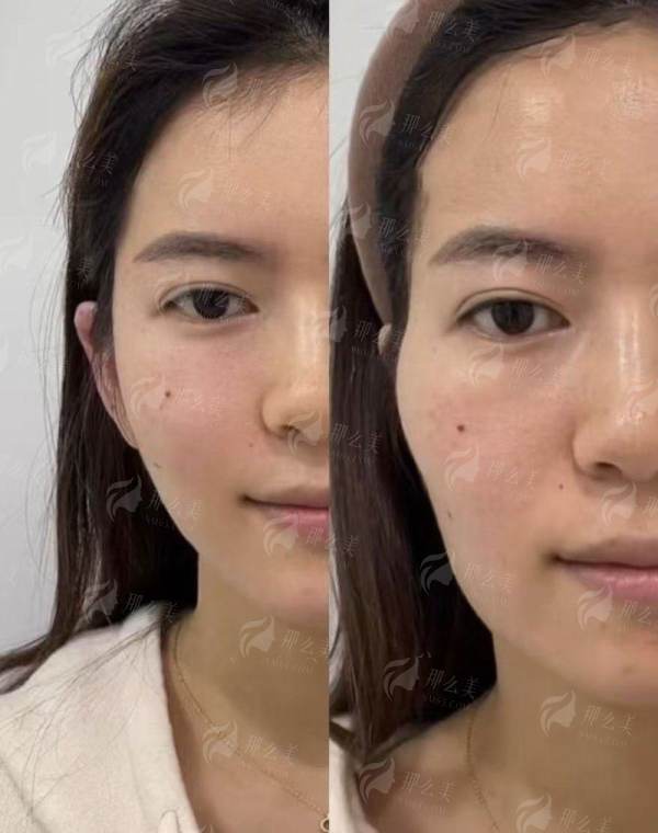 <strong>三、在云南昆明韩辰医疗美容医院做双眼皮该如何预约与准备？</strong>