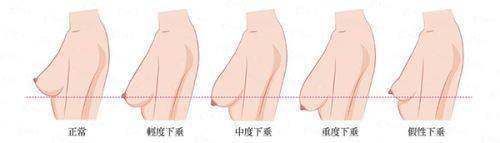 <strong>四、大连恩盈美地整形提眉与其他机构比，怎么选？</strong>