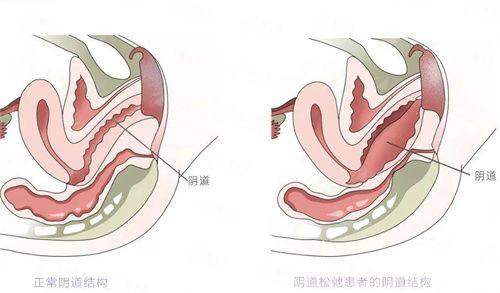 <strong>四、<strong>重庆华美整形外科医院的隆胸修复如何预约与相关参考？</strong></strong>