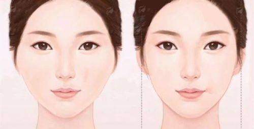<strong>四、<strong>如何预约芜湖壹加壹的开眼角面诊？</strong></strong>