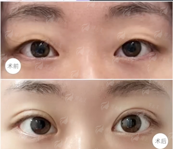 <strong>三、贵阳利美康外科医院与贵阳华美紫馨的疤痕修复有什么优势？</strong>