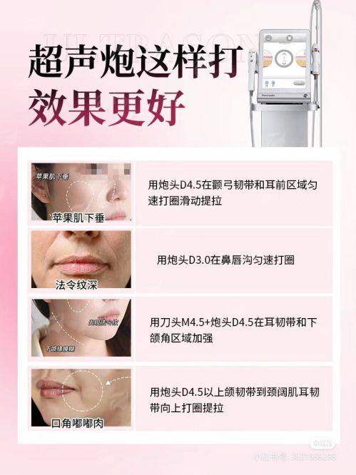 王章霞vs陈柳艺，苏州薇琳双眼皮如何选择？新颜智尚小程序预约，享优先面诊与价格优惠