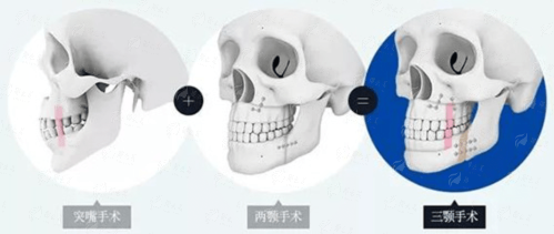 <strong>一键查看与预约周先华医生的便捷通道</strong>