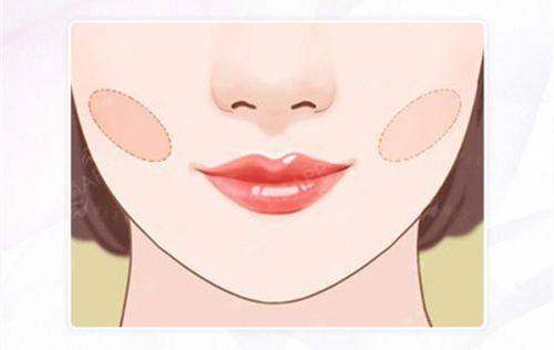 <strong style="color: rgb(255, 0, 0);">四、体验升级:广州中中家医的服务与术后护理体系</strong>