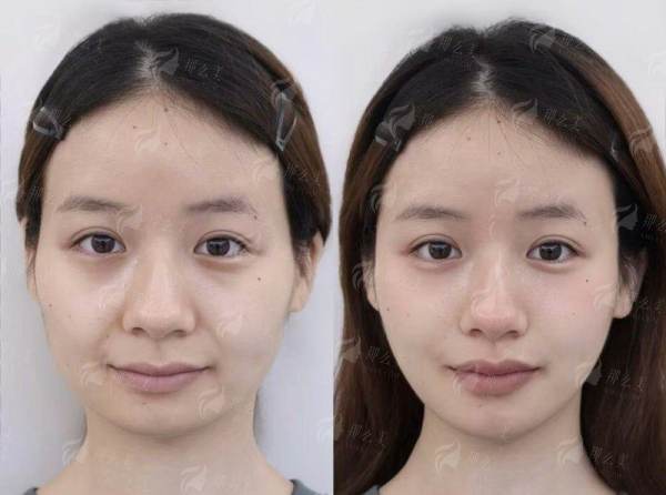 <strong>为何选择广州中中家医体验艾维岚上瘾红?特殊医院特色与实力揭秘</strong>