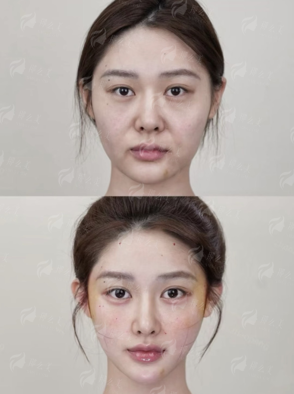 <strong>深度解析:唐新辉院长的隆胸技术优势有哪些?</strong>