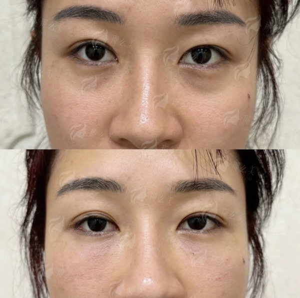 <strong>如何预约河南整形美容医院刘凤斌医生进行面诊?</strong>