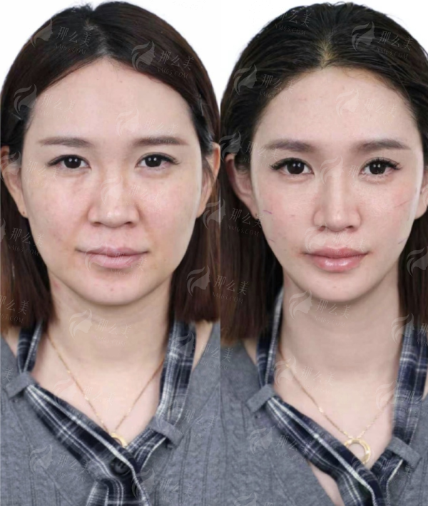 <strong>揭秘杭州天鑫肖文明的高难度眼修复核心技术优势</strong>