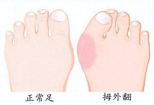 <strong>北京丽合郭锋专项超能光雕不开刀祛眼袋价格贵吗？</strong>