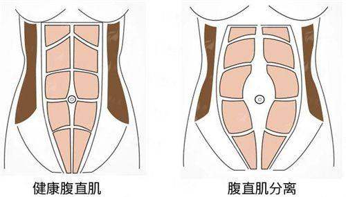 <strong>深圳安美聚光身体塑型特色仪器与个性化方案</strong>