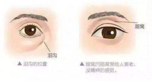 <strong>二、台州维多利亚医疗美容医院的双眼皮整形技术好吗?</strong>